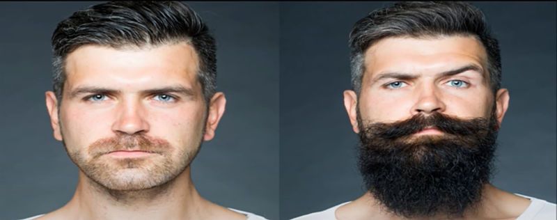 comparativo "antes e depois" de homem que utilizou minoxidil para crescimento da barba